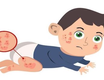 Apa Itu Alergi Susu Sapi, Dampak, dan Cara Mencegahnya? Simak Penjelasannya