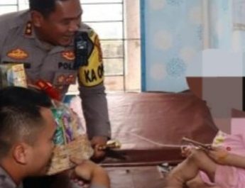 Polisi Selidiki Kasus Penyiksaan Anak 10 Tahun di Lolowau Nias Selatan