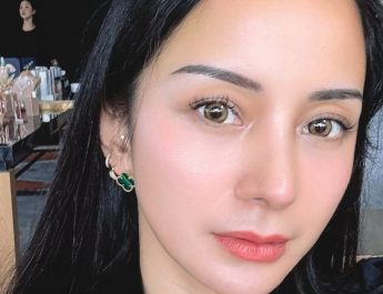 Kirana Larasati Pilih Operasi Hidung di Thailand, Ini Tips Perawatan setelah Operasi Hidung 