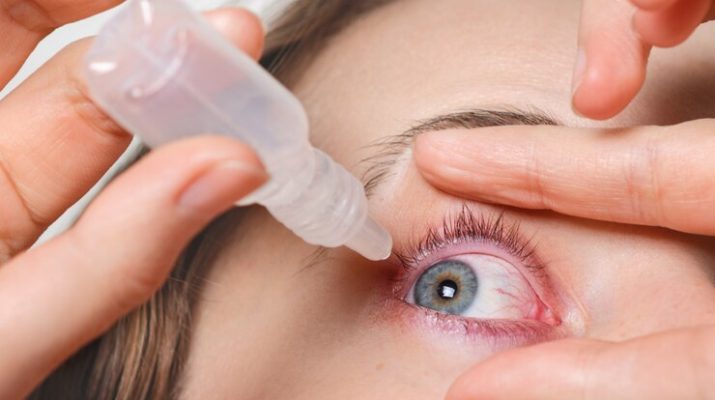 Tips Memilih Softlens yang Aman untuk Mata, Ini Rekomendasi Dokter