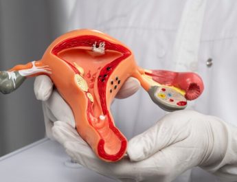 Waspadai 10 Tanda dan Gejala Kanker Ovarium yang Jarang Diketahui