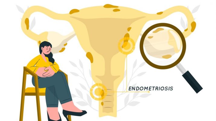 Tiga Cara Pemeriksaan Tuba Falopi, Kerusakan Terbanyak Disebabkan Infeksi dan Endometriosis