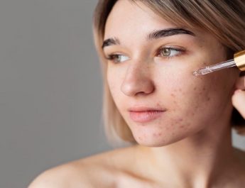 6 Rekomendasi Cleansing Oil Terbaik untuk Kulit Acne-Prone
