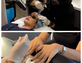 YELLO Hotel Paskal Bandung Manjakan Wanita di Hari Kartini dengan Program Spesial