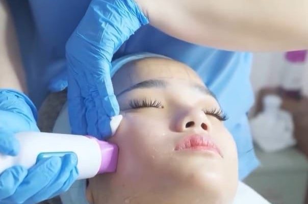 Thermage FLX Jadi Rahasia Kulit Kencang Tanpa Pisau Bedah