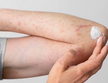 Kulit Sensitif? Tips Pilih Produk Kecantikan Aman!