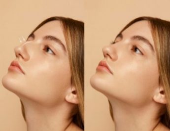 Jawline Adalah: Definisi, Jenis, dan Rahasia Garis Rahang Tajam