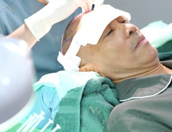 Klinik Spesialis Transplantasi Rambut Hadir di Surabaya